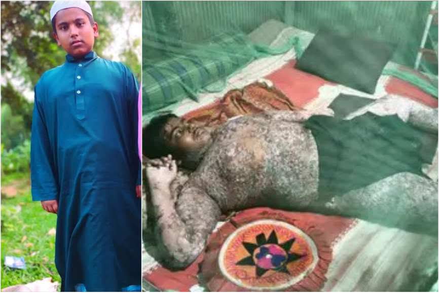 বাঁচতে চায় কুবির নৈশপ্রহরীর ছেলে সিয়াম